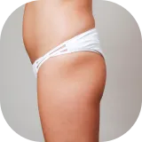Bumbum caído